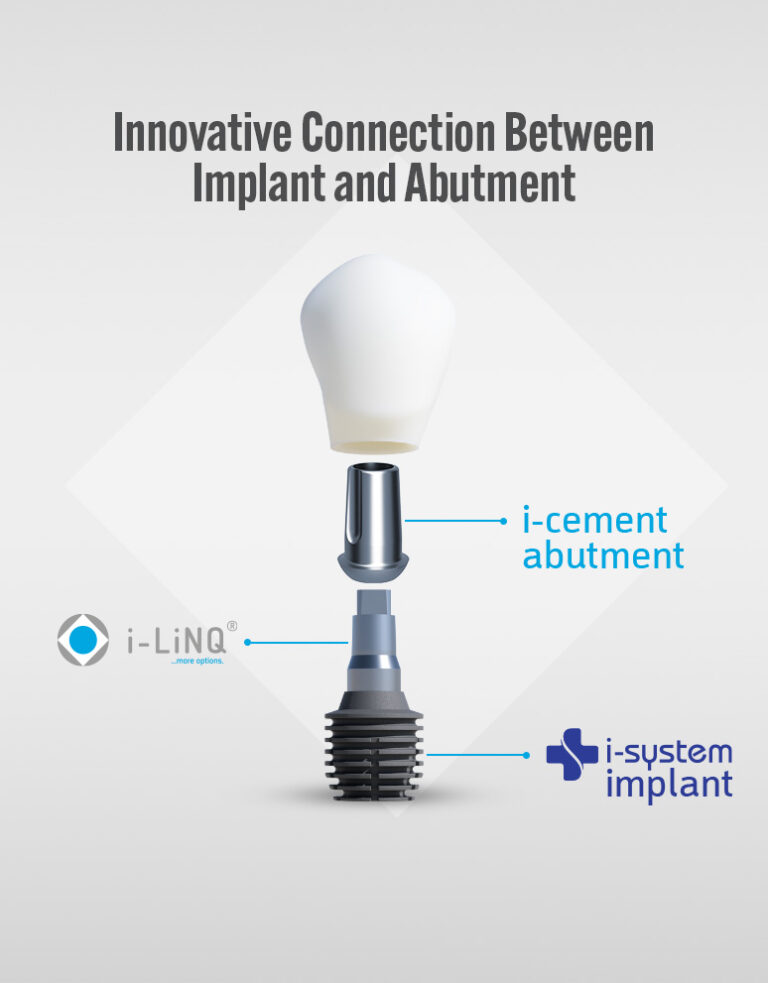 ilinq implant